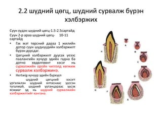 2.2 шүдний цөгц, шүдний сурвалж бүрэн
хэлбэржих
Сүүн үүдэн шүдний цөгц-1.5-2.5сартайд
Сүүн 2-р араа шүдний цөгц- 10-11
сартайд
• Гэх мэт төрсний дараа 1 жилийн
дотор сүүн шүднүүдийн хэлбэржилт
бүрэн дуусдаг.
• Цөгцний хэлбэржилт дуусах үеээс
паалангийн хучуур эдийн гадна ба
дотно хөдөлгөөнт хэсэг нь
сурвалжийн оройн чиглэлд хөгжиж
сурвалж хэлбэржинэ.
• Hertwig-хучуур эдийн бүрхүүл
шүдний цөгцний хэсэгт
үргэлжлэн шүдний ялтаснаас үүссэн
тугалмай, шүдний уутанцараас үүсэх
ясжмаг эд нь шүдний сурвалжийн
хэлбэржилтийг хангана.
 