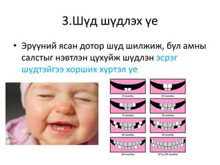 3.Шүд шүдлэх үе
• Эрүүний ясан дотор шүд шилжиж, бул амны
салстыг нэвтлэн цухуйж шүдлэн эсрэг
шүдтэйгээ хорших хүртэл үе
 
