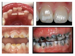 шүдний өсөлт хөгжил