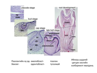 Паалангийн ху.эд- амелобласт- паалан
Хөхлөг- одонтобласт- тугалмай
Ийнхүү шүдний
цөгцөн хэсгийн
хэлбэржилт явагдана.
 