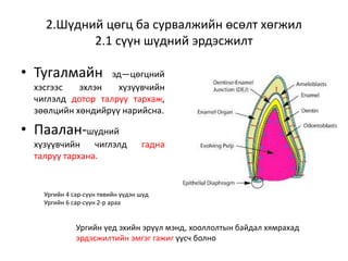 2.Шүдний цөгц ба сурвалжийн өсөлт хөгжил
2.1 сүүн шүдний эрдэсжилт
• Тугалмайн эд—цөгцний
хэсгээс эхлэн хүзүүвчийн
чиглэлд дотор талруу тархаж,
зөөлцийн хөндийрүү нарийсна.
• Паалан-шүдний
хүзүүвчийн чиглэлд гадна
талруу тархана.
Ургийн үед эхийн эрүүл мэнд, хооллолтын байдал хямрахад
эрдэсжилтийн эмгэг гажиг үүсч болно
Ургийн 4 сар-сүүн төвийн үүдэн шүд
Ургийн 6 сар-сүүн 2-р араа
 