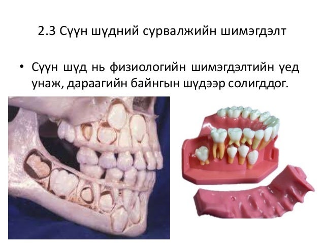 шүдний өсөлт хөгжил