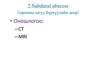 2.Subdural abscess
/тархины хатуу бүрхүүлийн доор/
• Оношлогоо:
–CT
–MRI
 