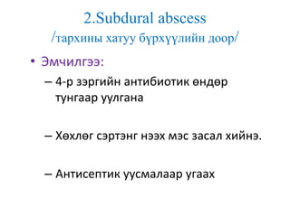 2.Subdural abscess
/тархины хатуу бүрхүүлийн доор/
• Эмчилгээ:
– 4-р зэргийн антибиотик өндөр
тунгаар уулгана
– Хөхлөг сэртэнг нээх мэс засал хийнэ.
– Антисептик уусмалаар угаах
 