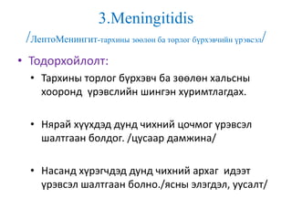 3.Meningitidis
/ЛептоМенингит-тархины зөөлөн ба торлог бүрхэвчийн үрэвсэл/
• Тодорхойлолт:
• Тархины торлог бүрхэвч ба зөөлөн хальсны
хооронд үрэвслийн шингэн хуримтлагдах.
• Нярай хүүхдэд дунд чихний цочмог үрэвсэл
шалтгаан болдог. /цусаар дамжина/
• Насанд хүрэгчдэд дунд чихний архаг идээт
үрэвсэл шалтгаан болно./ясны элэгдэл, уусалт/
 