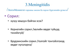 3.Meningitidis
/ЛептоМенингит-тархины зөөлөн ба торлог бүрхэвчийн үрэвсэл/
• Сорил:
• хүзүү хөшүүн байгаа эсэх?
• Кернегийн сорил /хөлийн өвдөг гүйцэд
тэнийхгүй/
• Брудзинскийн сорил /толгойг тонгойлгоход
өвдөг нугаларна/
 