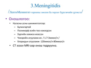 3.Meningitidis
/ЛептоМенингит-тархины зөөлөн ба торлог бүрхэвчийн үрэвсэл/
• Оношлогоо:
• Нугасны усны шинжилгээгээр:
– Булингартай
– Полиморф эсийн тоо нэмэгдсэн
– Уургийн хэмжээ ихэссэн
– Чихэрийн агууламж их / 1.7-3ммол/л /
– Хлоридын агууламж- 120ммол/л-80ммол/л
• CT эсвэл MRI-аар онош тодруулна.
 