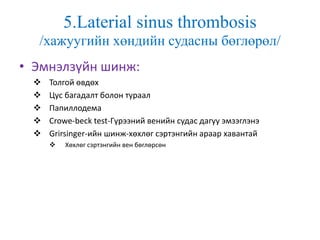 5.Laterial sinus thrombosis
/хажуугийн хөндийн судасны бөглөрөл/
• Эмнэлзүйн шинж:
 Толгой өвдөх
 Цус багадалт болон тураал
 Папиллодема
 Crowe-beck test-Гүрээний венийн судас дагуу эмзэглэнэ
 Grirsinger-ийн шинж-хөхлөг сэртэнгийн араар хавантай
 Хөхлөг сэртэнгийн вен бөглөрсөн
 