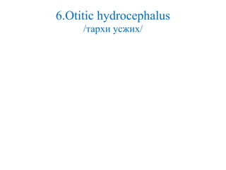 6.Otitic hydrocephalus
/тархи усжих/
 
