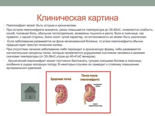Клиническая картина
• Пиелонефрит может быть острым и хроническим.
• При остром пиелонефрите внезапно, резко повышается температура до 39-40оС, появляются слабость,
озноб, головная боль, обильное потоотделение, возможны тошнота и рвота, боли в пояснице, как
правило, с одной стороны. Боли носят тупой характер, но интенсивность их может быть различная.
• Если заболевание развивается на фоне мочекаменной болезни, то атаке пиелонефрита обычно
предшествует приступ почечной колики.
• При отсутствии лечения заболевание либо переходит в хроническую форму, либо развиваются
нагноительные процессы почки, которые проявляются ухудшением состояния человека и резкими
скачками температуры (от 35-36оС утром до 40-41оС вечером).
• . Хронический пиелонефрит может постоянно беспокоить тупыми ноющими болями в пояснице,
особенно в сырую холодную погоду. В некоторых случаях он приводит к стойкому повышению
артериального давления
 