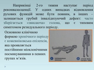Наприкінці 2-го тижня наступає період
реконвалесценції. У одних випадках відновлення
рухових функцій може бути повним, в інших –
залишається грубий інвалідизуючий дефект: часто
зберігається «звисаюча» голова, що є типовим
симптомом резидуального періоду.
Основною клінічною
формою хронічного періоду
є кожевніковська епілепсія,
яка проявляється
постійними міоклонічними
посмикуваннями в певних
групах м’язів.
 
