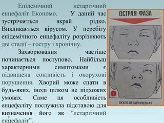 Епідемічний летаргічний
енцефаліт Економо. У даний час
зустрічається вкрай рідко.
Викликається вірусом. У перебігу
епідемічного енцефаліту розрізняють
дві стадії – гостру і хронічну.
Захворювання частіше
починається поступово. Найбільш
характерними симптомами є
підвищена сонливість і окорухові
порушення. Хворий може спати в
будь-яких, іноді цілком не підхожих
умовах. Саме ця особливість
енцефаліту послужила підставою для
визначення його як “летаргічний
енцефаліт”.
 