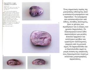 Ένας σημαντικός τομέας της
μυκηναϊκής λιθοτεχνίας ήταν
η κατασκευή κοσμημάτων και
σφραγίδων. Τα κοσμήματα
που κατασκευάζονταν από
λίθους, συνήθως πολύτιμους,
ήταν οι χάντρες των
περιδέραιων και οι πέτρες των
χρυσών δαχτυλιδιών. Οι
διακοσμητικοί αυτοί λίθοι
παρουσιάζουν μια μεγάλη
ποικιλία σχημάτων και
ανάγλυφων μοτίβων και
εμφανίζουν καλλιτεχνικές
επιρροές από τη μινωική
τέχνη. Οι σφραγιδόλιθοι και
οι δακτυλιόλιθοι παρά τη
μικρή έκταση της επιφάνειάς
τους διακοσμούνταν συχνά με
ανάγλυφες μικρογραφικές
παραστάσεις.
 