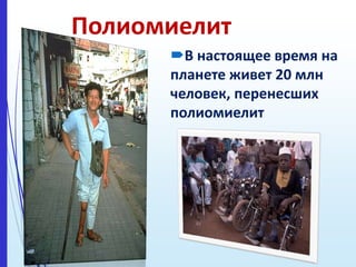 Полиомиелит
В настоящее время на
планете живет 20 млн
человек, перенесших
полиомиелит
 