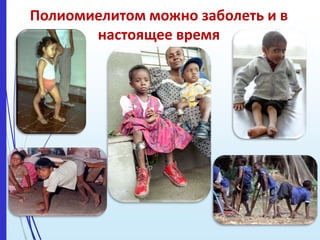 Полиомиелитом можно заболеть и в
настоящее время
 