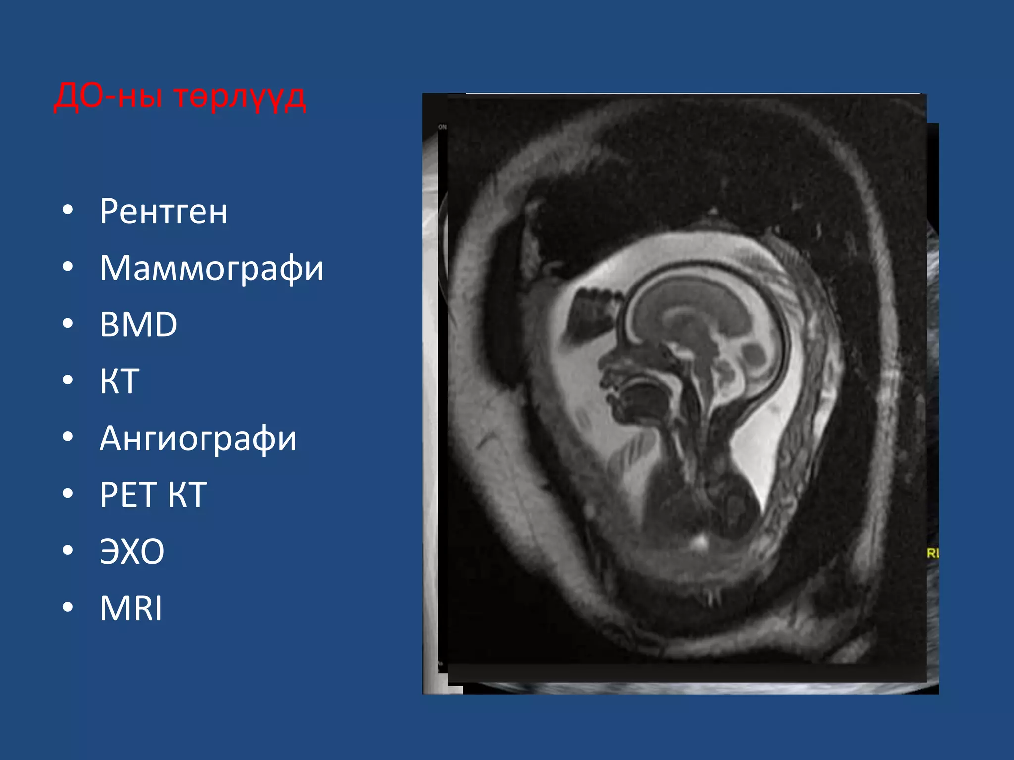 Хавдрын эрт илрүүлэг, оношилгоо | PPT