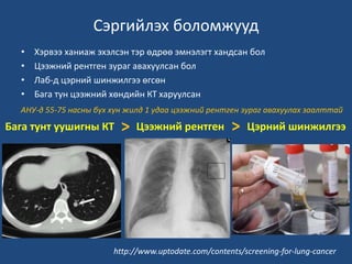 Хавдрын эрт илрүүлэг, оношилгоо | PPT
