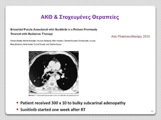 66
ΑΚΘ & Στοχευμένες Θεαπείες
 