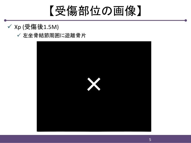 ハムストリングス起始部損傷を伴う坐骨結節剥離骨折術後のアスレティック・リハビリテーションハムストリングス起始部損傷を伴う坐骨結節剥離骨折術後のアスレティック・リハビリテーション