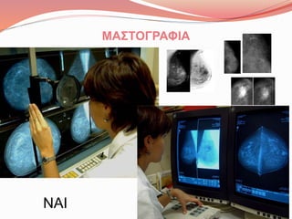 ΜΑΣΤΟΓΡΑΦΙΑ
ΝΑΙ
 