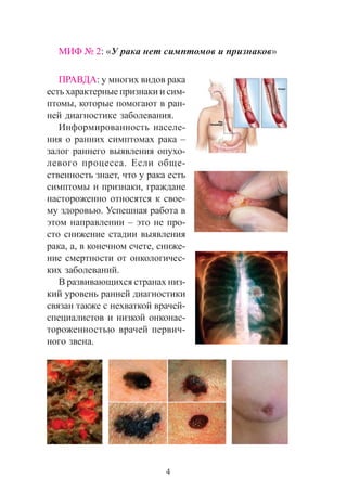4
ÌÈÔ ¹ 2: «Ó ðàêà íåò ñèìïòîìîâ è ïðèçíàêîâ»
ÏÐÀÂÄÀ: ó ìíîãèõ âèäîâ ðàêà
åñòü õàðàêòåðíûå ïðèçíàêè è ñèì-
ïòîìû, êîòîðûå ïîìîãàþò â ðàí-
íåé äèàãíîñòèêå çàáîëåâàíèÿ.
Èíôîðìèðîâàííîñòü íàñåëå-
íèÿ î ðàííèõ ñèìïòîìàõ ðàêà –
çàëîã ðàííåãî âûÿâëåíèÿ îïóõî-
ëåâîãî ïðîöåññà. Åñëè îáùå-
ñòâåííîñòü çíàåò, ÷òî ó ðàêà åñòü
ñèìïòîìû è ïðèçíàêè, ãðàæäàíå
íàñòîðîæåííî îòíîñÿòñÿ ê ñâîå-
ìó çäîðîâüþ. Óñïåøíàÿ ðàáîòà â
ýòîì íàïðàâëåíèè – ýòî íå ïðî-
ñòî ñíèæåíèå ñòàäèè âûÿâëåíèÿ
ðàêà, à, â êîíå÷íîì ñ÷åòå, ñíèæå-
íèå ñìåðòíîñòè îò îíêîëîãè÷åñ-
êèõ çàáîëåâàíèé.
Â ðàçâèâàþùèõñÿ ñòðàíàõ íèç-
êèé óðîâåíü ðàííåé äèàãíîñòèêè
ñâÿçàí òàêæå ñ íåõâàòêîé âðà÷åé-
ñïåöèàëèñòîâ è íèçêîé îíêîíàñ-
òîðîæåííîñòüþ âðà÷åé ïåðâè÷-
íîãî çâåíà.
 