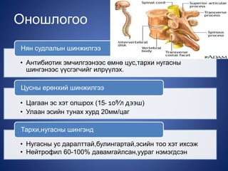 Оношлогоо
• Антибиотик эмчилгээнээс өмнө цус,тархи нугасны
шингэнээс үүсгэгчийг илрүүлэх.
Нян судлалын шинжилгээ
• Цагаан эс хэт олшрох (15∙ 10⁹⁄л дээш)
• Улаан эсийн тунах хурд 20мм/цаг
Цусны ерөнхий шинжилгээ
• Нугасны ус даралттай,булингартай,эсийн тоо хэт ихсэж
• Нейтрофил 60-100% давамгайлсан,уураг нэмэгдсэн
Тархи,нугасны шингэнд
 