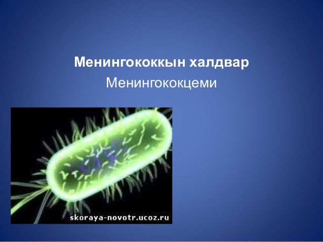 гар, хөл, амны өвчин