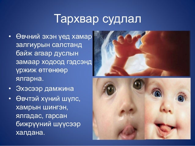 гар, хөл, амны өвчин
