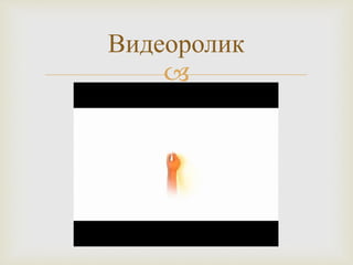 
Видеоролик
 