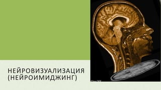 НЕЙРОВИЗУАЛИЗАЦИЯ
(НЕЙРОИМИДЖИНГ)
 