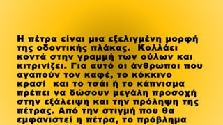 Η πέτρα είναι μια εξελιγμένη μορφή
της οδοντικής πλάκας. Κολλάει
κοντά στην γραμμή των ούλων και
κιτρινίζει. Για αυτό οι άνθρωποι που
αγαπούν τον καφέ, το κόκκινο
κρασί  και το τσάι ή το κάπνισμα
πρέπει να δώσουν μεγάλη προσοχή
στην εξάλειψη και την πρόληψη της
πέτρας. Από την στιγμή που θα
εμφανιστεί η πέτρα, το πρόβλημα
 