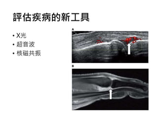 評估疾病的新工具
• X光
• 超音波
• 核磁共振
 