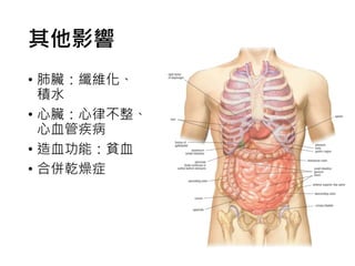 其他影響
• 肺臟：纖維化、
積水
• 心臟：心律不整、
心血管疾病
• 造血功能：貧血
• 合併乾燥症
 