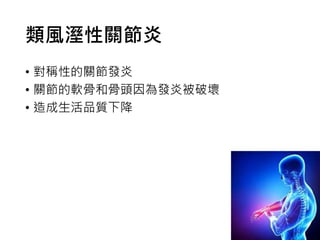 類風溼性關節炎
• 對稱性的關節發炎
• 關節的軟骨和骨頭因為發炎被破壞
• 造成生活品質下降
 