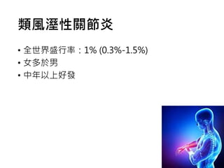 類風溼性關節炎
• 全世界盛行率：1% (0.3%-1.5%)
• 女多於男
• 中年以上好發
 