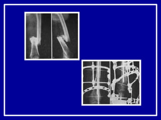 ложные суставы