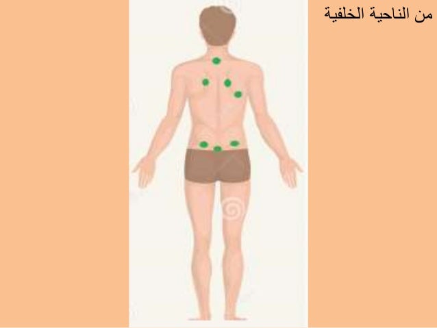 الحجامة,فوائدها, مواضع الحجامة, الامراض التى تعالجها -12-638