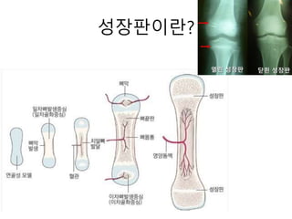 성장판이란?
 