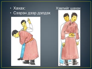 • Хахах:
• Сээрэн дээр дэлдэх
Хэвлийг шахах
 