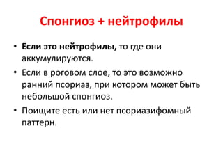 • Если обнаружен спонгиоз с растяжением
межклеточных мостиков, то нужно
обратить внимание, сопровождается или
нет спогиоз клеточной инфильтрацией
эпидермиса?
• Являются инфильтрующие клетки
нейтрофилами, лимфоцитами или
эозинофилами?
 