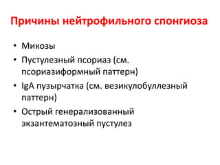 Спонгиоз + нейтрофилы
• Если это нейтрофилы, то где они
аккумулируются.
• Если в роговом слое, то это возможно
ранний псориаз, при котором может быть
небольшой спонгиоз.
• Поищите есть или нет псориазифомный
паттерн.
 