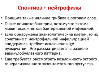 Причины нейтрофильного спонгиоза
• Микозы
• Пустулезный псориаз (см.
псориазиформный паттерн)
• IgA пузырчатка (см. везикулобуллезный
паттерн)
• Острый генерализованный
экзантематозный пустулез
 