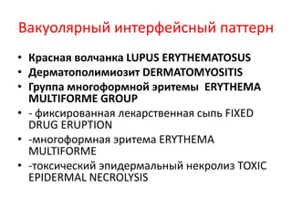 Лихеноидный интерфейсный паттерн
• Плоский лишай LICHEN PLANUS
• Плоский волосяной лишай LICHEN
PLANOPILARIS
• Блестящий лишай LICHEN NITIDUS
• Лихеноидные лекарственные высыпания
LICHENOID DRUG ERUPTION
 