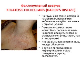 • Прямая и непрямая иммунофлюоресценция
отрицательные.
 