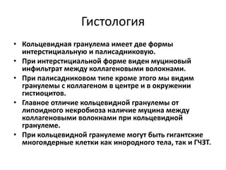 Гистология
• Кольцевидная гранулема имеет две формы
интерстициальную и палисадниковую.
• При интерстициальной форме виден муциновый
инфильтрат между коллагеновыми волокнами.
• При палисадниковом типе кроме этого мы видим
гранулемы с коллагеном в центре и в окружении
гистиоцитов.
• Главное отличие кольцевидной гранулемы от
липоидного некробиоза наличие муцина между
коллагеновыми волокнами при кольцевидной
гранулеме.
• При кольцевидной гранулеме могут быть гигантские
многоядерные клетки как инородного тела, так и ГЧЗТ.
 