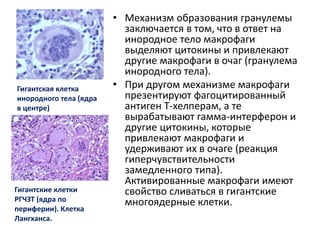 • Механизм образования гранулемы
заключается в том, что в ответ на
инородное тело макрофаги
выделяют цитокины и привлекают
другие макрофаги в очаг (гранулема
инородного тела).
• При другом механизме макрофаги
презентируют фагоцитированный
антиген Т-хелперам, а те
вырабатывают гамма-интерферон и
другие цитокины, которые
привлекают макрофаги и
удерживают их в очаге (реакция
гиперчувствительности
замедленного типа).
Активированные макрофаги имеют
свойство сливаться в гигантские
многоядерные клетки.
Гигантская клетка
инородного тела (ядра
в центре)
Гигантские клетки
РГЧЗТ (ядра по
периферии). Клетка
Лангханса.
 