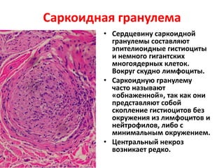 • Сердцевину саркоидной
гранулемы составляют
эпителиоидные гистиоциты
и немного гигантских
многоядерных клеток.
Вокруг скудно лимфоциты.
• Саркоидную гранулему
часто называют
«обнаженной», так как они
представляют собой
скопление гистиоцитов без
окружения из лимфоцитов и
нейтрофилов, либо с
минимальным окружением.
• Центральный некроз
возникает редко.
Саркоидная гранулема
 