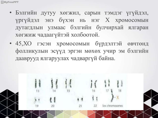 бэлгийн хромосомын эмгэгүүд