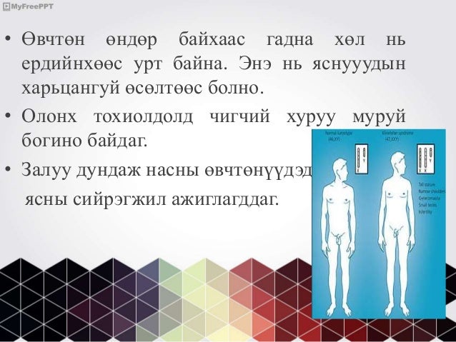 бэлгийн хромосомын эмгэгүүд