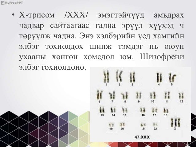 бэлгийн хромосомын эмгэгүүд